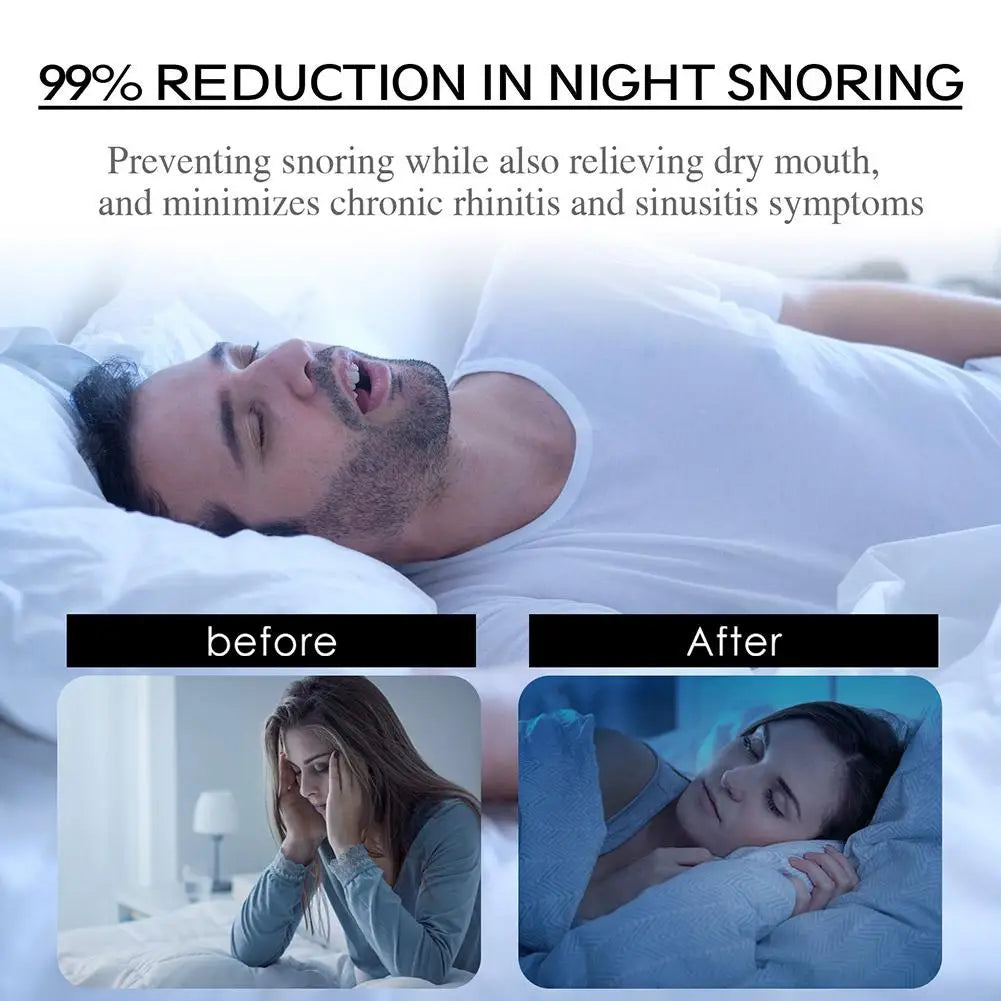 Stop Snoring Patch Nose Breathing Correction